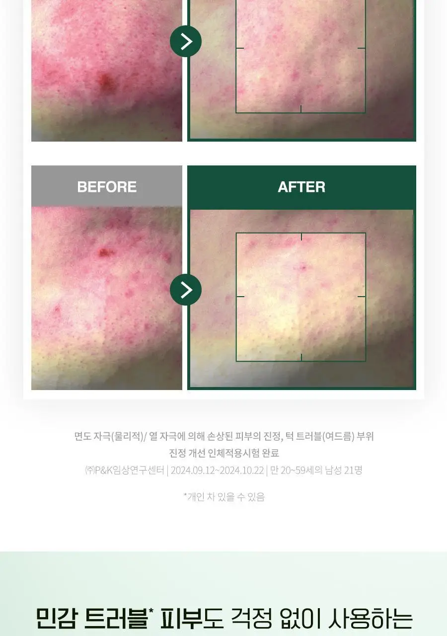 [new] 닥터지 레드 블레미쉬 포 맨 토너/진정올인원 2종 기획 (+미니어처 2종) 상세페이지 17